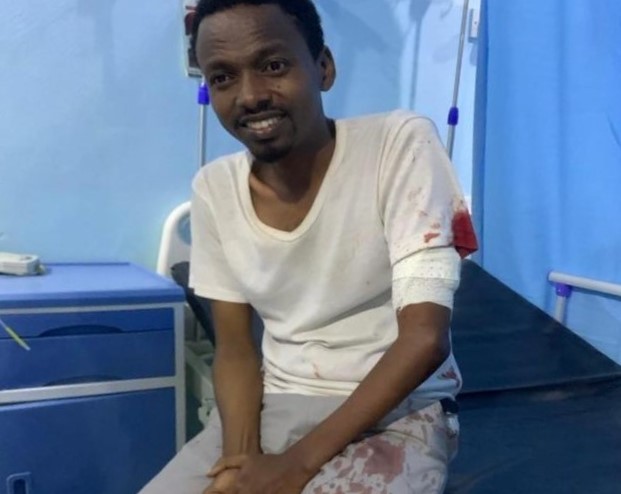 Somali journalist Hanad Ali Guled is seen after being beaten and attacked with a knife on June 23, 2021. (Photo: Somali Journalists Syndicate)