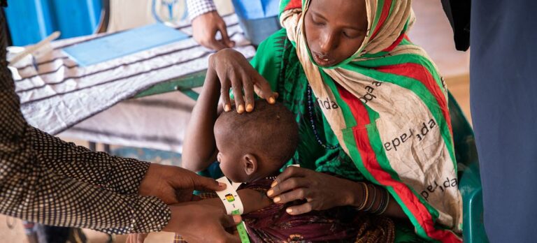 © WFP/Samantha Reinders A one-year-old girl is treated for malnutrition at a WFP-funded clinic in Dolow in Somalia.